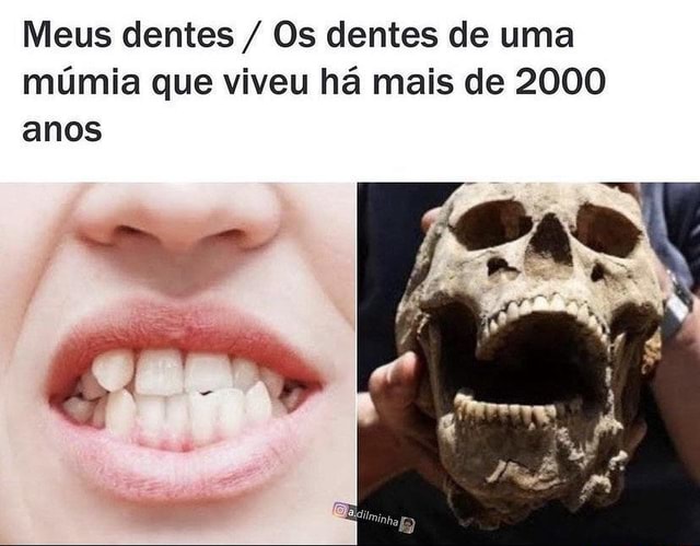 Meus Dentes Os Dentes De Uma M Mia Que Viveu H Mais De Anos