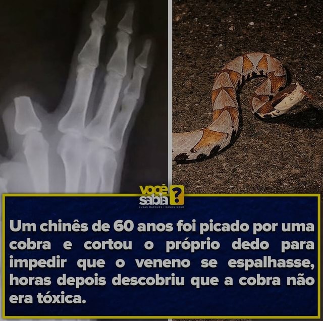 Um chinês de 60 anos foi picado por uma cobra e cortou o próprio dedo