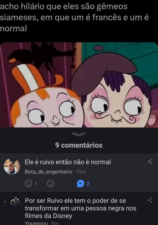 Acho Hil Rio Que Eles S O G Meos Siameses Em Que Um Franc S E Um