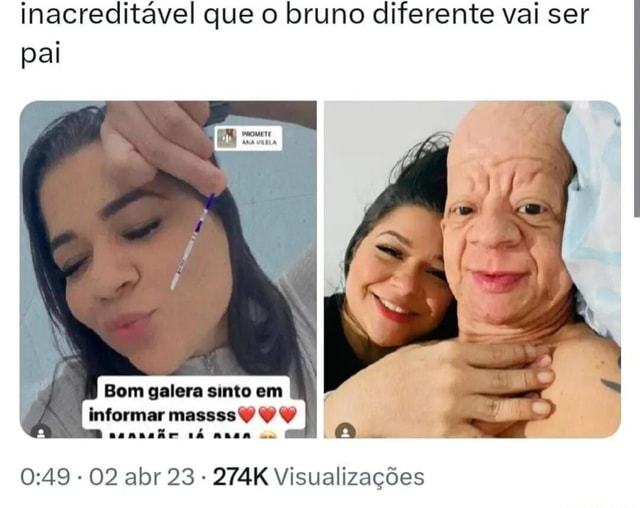 bruno diferente filho