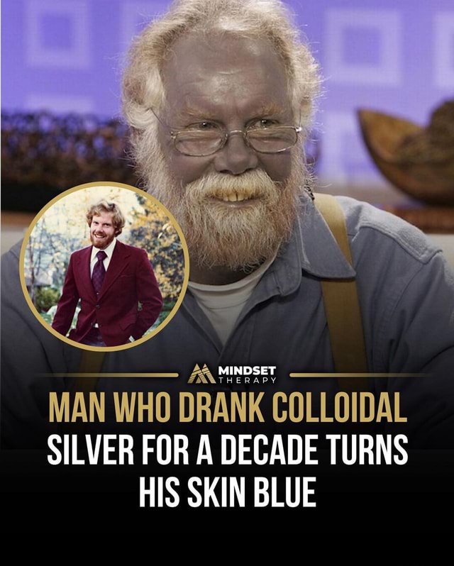 Why this man's skin turned blue