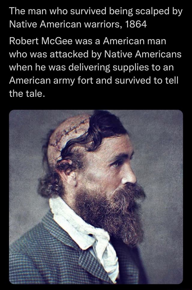 The man who survived being scalped by Native American warriors, 1864 ...