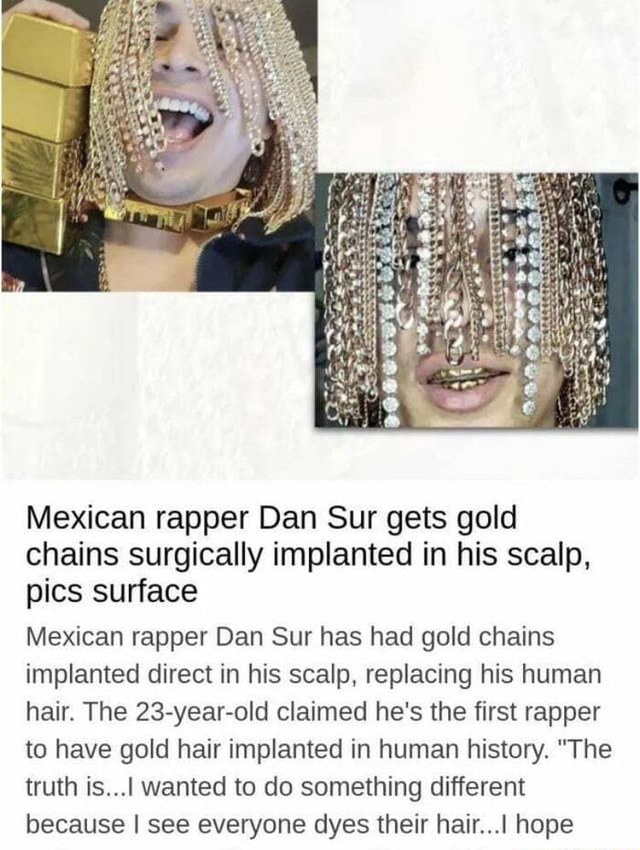 Mexican rapper Dan Sur gets gold chains surgically implanted into his  scalp, leaves fans shocked with his bizarre look | English Movie News -  Hollywood - Times of India