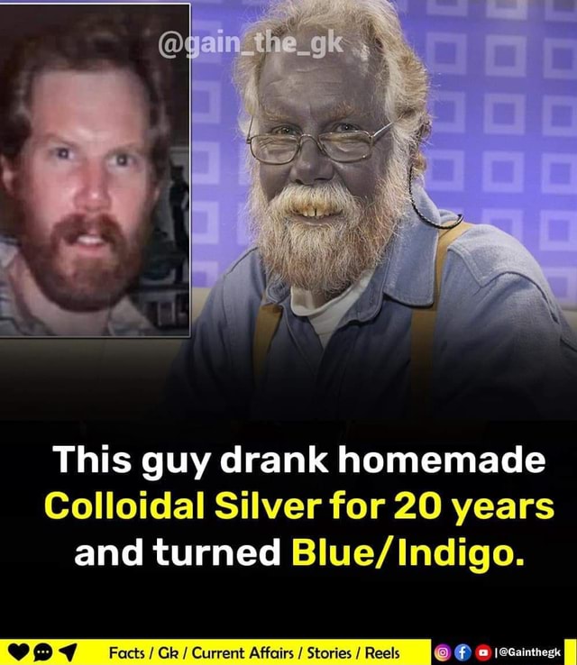 A man drank colloidal silver for over a decade and his skin turned blue :  r/interestingasfuck