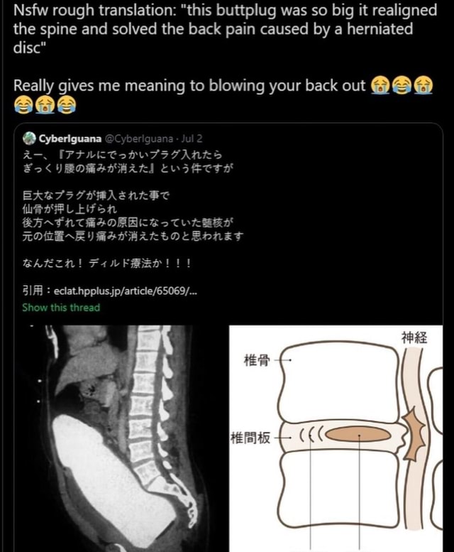 Nsfw rough translation: this buttplug was so big it realigned the spine  and solved the back pain caused by a herniated disc Really gives me meaning  to blowing your back out @