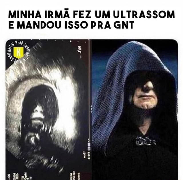 MINHA IRMÃ FEZ UM ULTRASSOM E MANDOU ISSO PRA GNT ME y - iFunny Brazil