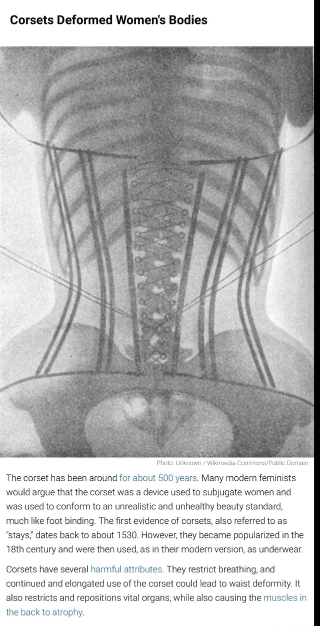 Corsets Deformed Women's Bodies Photo: Unkno\ Nikimedia Domain The corset  has been around for about 500 years. Many modern feminists would argue that  the corset was a device used to subjugate women