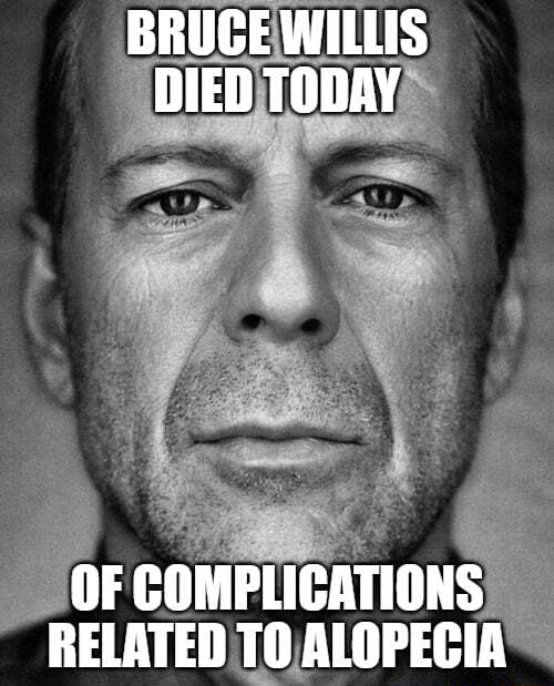 BRUCE WILLIS DIED TODAY OF COMPLICATIONS RELATER TA ALOPECIA - iFunny ...