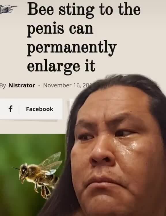 Bee sting to the penis can permanently enlarge it By Nistrator